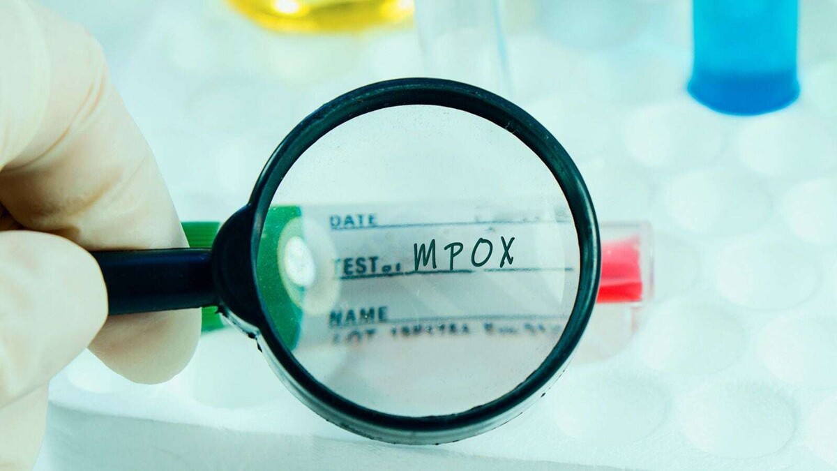 Burundi Faces Health Crisis as Mpox Cases Rise