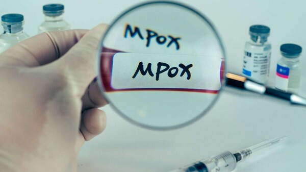 Burundi Reports Rise in Mpox Cases Among Youth