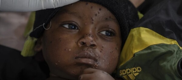 WHO Warns of Global Threat from Mpox Virus